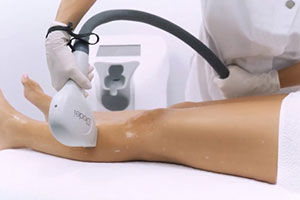 Primelase hair removal treatment